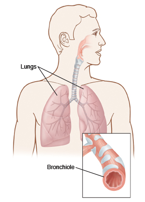 Illustration of the lungs and a close-up view of a bronchiole.