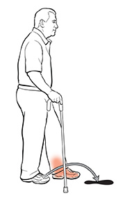 Side view of a man using a cane. The arrow shows where he should put his other foot.