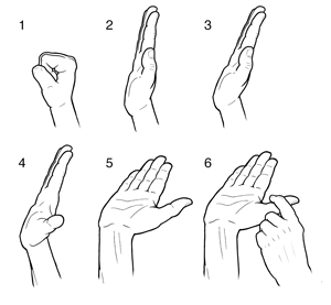 Six steps showing a hand doing median nerve glide stretch. 